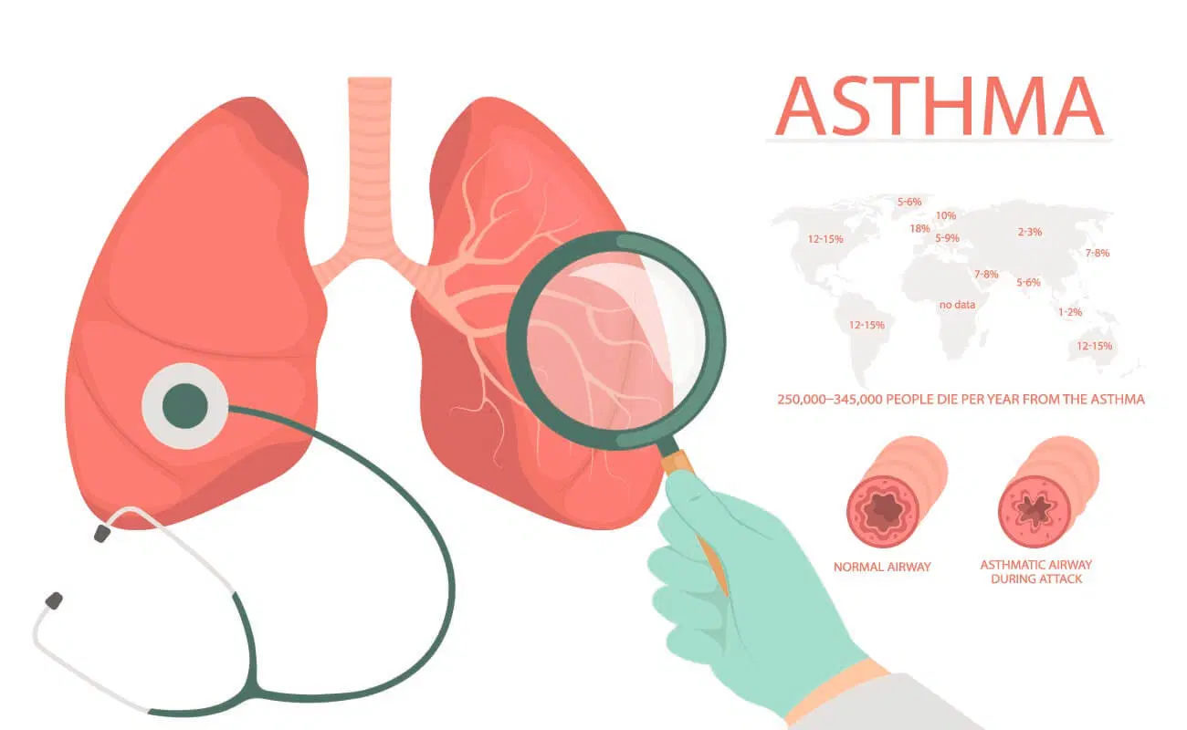 Asthma